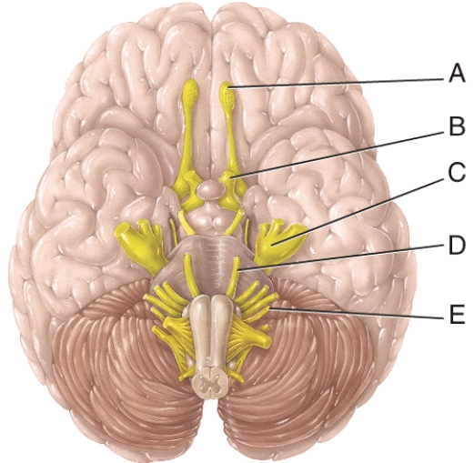 In the figure, the Vagus cranial nerve would be represented by:   A)  A B)  B C)  C D)  D E)  E