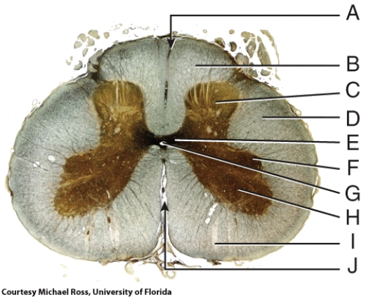 In the figure, where is the posterior median sulcus?   A)  A B)  E C)  F D)  H E)  J