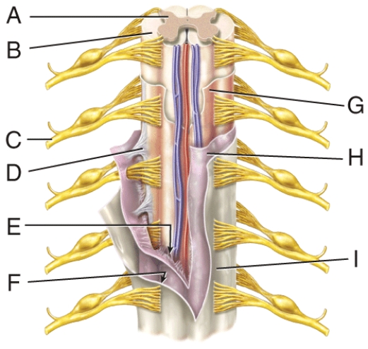 In the figure, where is the denticulate ligament?   A)  C B)  D C)  F D)  H E)  I