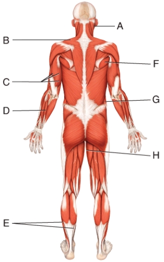 Where is the triceps brachii?   A)  D B)  E C)  C D)  I E)  None of these choices