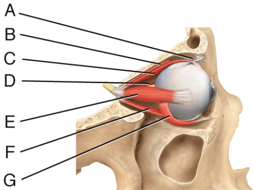 Where is the inferior rectus?   A)  A B)  C C)  E D)  F E)  G