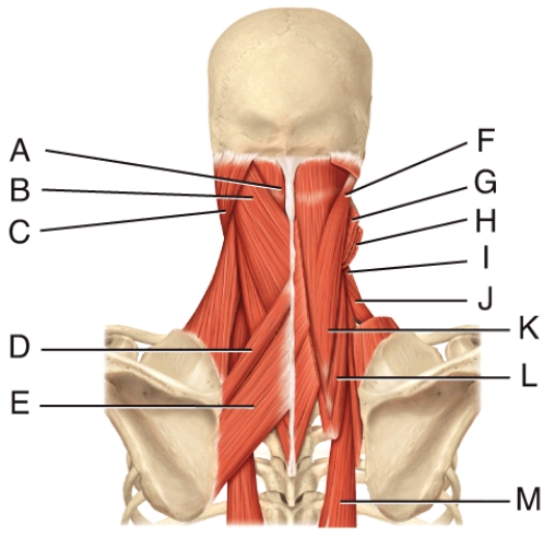 Where is the rhomboid minor?   A)  D B)  E C)  F D)  P E)  Q