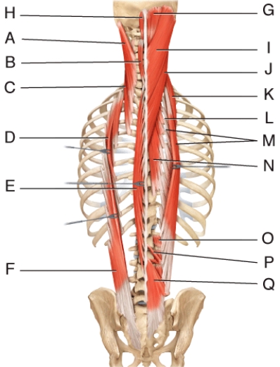 Where is the semispinalis capitis?   A)  D B)  E C)  F D)  G E)  P