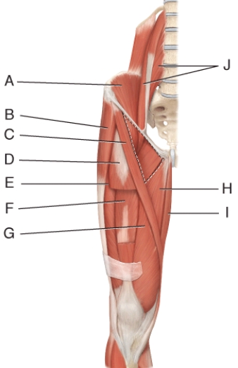 Where is the vastus intermedius?   A)  D B)  E C)  F D)  G E)  H