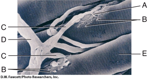 In the diagram, where is the axon collateral?   A)  B B)  C C)  D D)  E E)  None of these choices