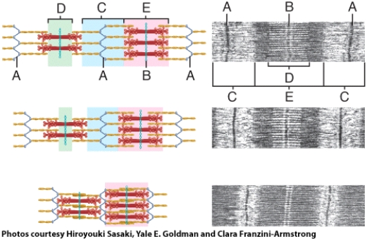 In the diagram, where is thin filament found?   A)  C B)  E C)  B D)  Both C and E E)  All of these choices