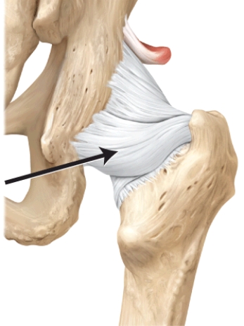 What is this structure?   A)  pubofemoral ligament B)  coracohumeral ligament C)  iliofemoral ligament D)  oblique popliteal ligament E)  ischiofemoral ligament