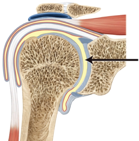 Identify this structure.   A)  acetabulum B)  glenoid cavity C)  acromion D)  coracoid process E)  femoral head