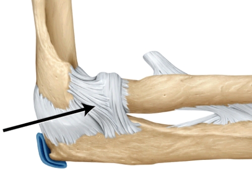 What is this structure?   A)  annular ligament of the radius B)  coracohumeral ligament C)  radial collateral ligament D)  oblique popliteal ligament E)  ulnar collateral ligament