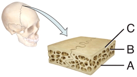 In the diagram of a suture joint, where is the spongy bone?   A)  A B)  B C)  C D)  Both A and C E)  Both A and B