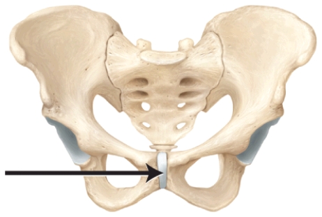 In the diagram, which type of joint is represented?   A)  suture B)  syndesmosis C)  symphysis D)  cartilaginous E)  synovial