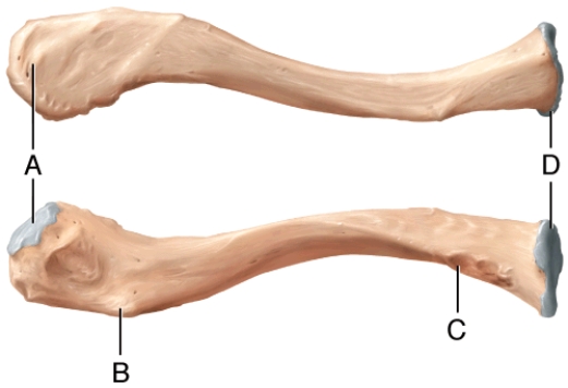 Which is the only part of the clavicle that articulates with the acromion?   A)  A B)  B C)  C D)  D E)  None of these choices
