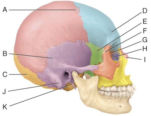 In the diagram, which bone is considered the keystone of the skull?   A)  E B)  B C)  G D)  H E)  I