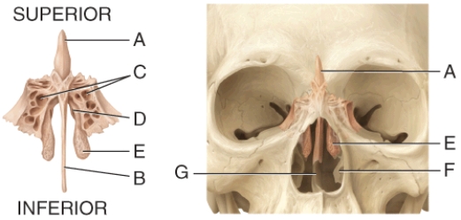 In the diagram, this region of the bone is covered by membranes that contain the receptors for the sense of smell.   A)  C B)  D C)  E D)  F E)  G