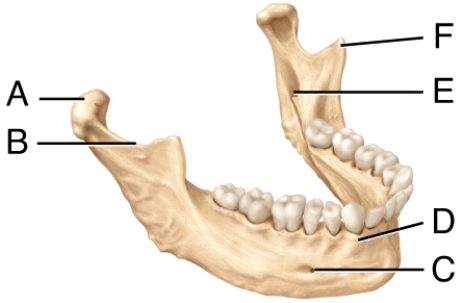 Where is the mandibular notch in the diagram?   A)  A B)  B C)  E D)  F E)  C