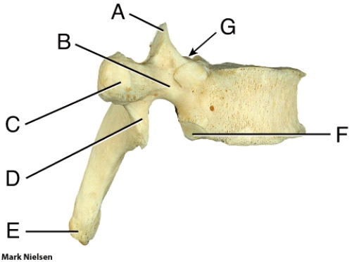 Where is the facet that articulates with the tubercle of the rib?   A)  B B)  C C)  D D)  E E)  F