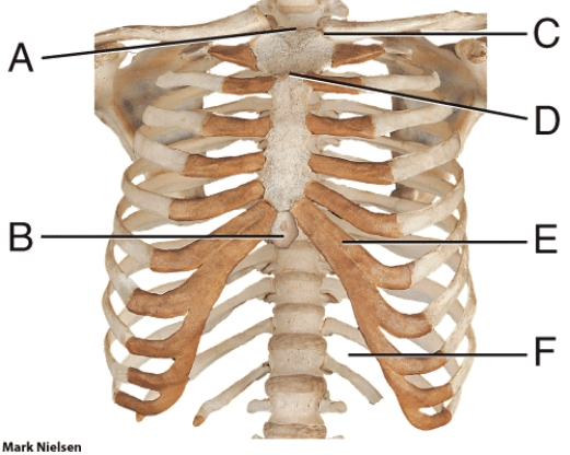In the diagram, which part is most often broken during CPR?   A)  A B)  B C)  D D)  F E)  E