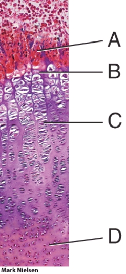 In the diagram, where is the zone of hypertrophic cartilage?   A)  A B)  B C)  C D)  D E)  E