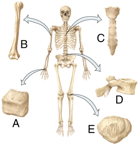In the diagram, which bone is the short bone?   A)  A B)  B C)  C D)  D E)  E