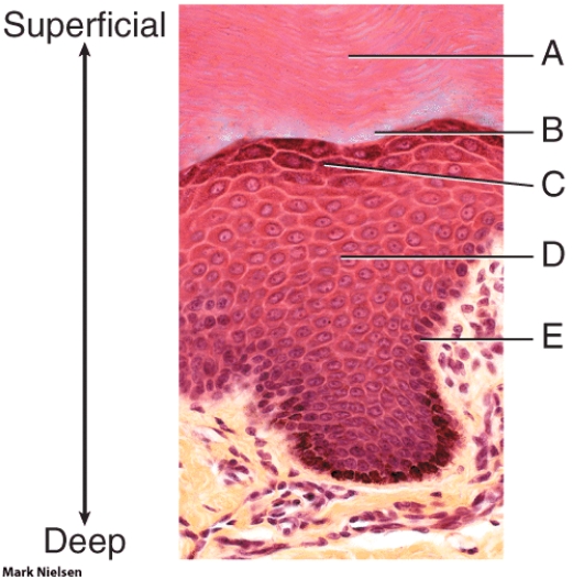 In the photomicrograph, which layer contains dying cells that have distinctive lipid-filled granules?   A)  A B)  B C)  C D)  D E)  E