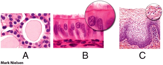 Which of these epithelial tissues is keratinized?   A)  A B)  B C)  C D)  A and B E)  None of these choices