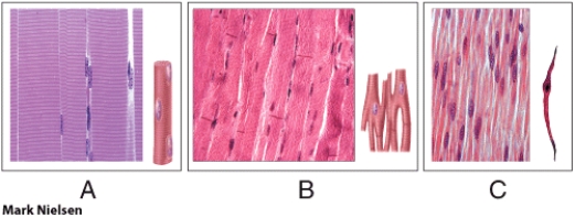 Which of the diagrams in the figure shown above is a cardiac muscle tissue?   A)  A only B)  B only C)  C only D)  A and B E)  None of these choices