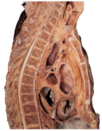 <strong>Along which of the following body planes has this section been made?  </strong> A) oblique B) frontal C) sagittal D) coronal E) transverse <div style=padding-top: 35px> 