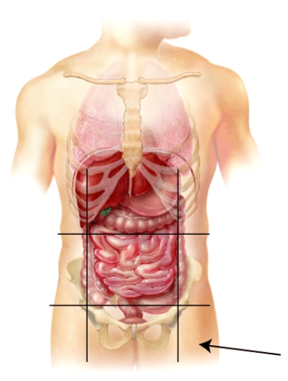 What is the name of this region?   A)  left hypochondriac B)  right Lumbar C)  left inguinal D)  hypogastric E)  mental