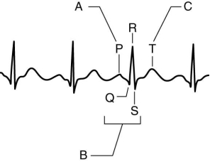 The Figure Above Shows a Normal ECG Recording | Biology+