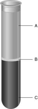   Using the figure above, answer the following question(s). -The blood component indicated by A is the ________.