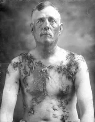 <strong> After German American farmer John Meints from Luverne, Minnesota, was beaten, tarred, and feathered by a group of his neighbors in 1918 for not buying war bonds, Meints used these photographs to .</strong> A) inform Germany of how German Americans were being treated in America B) complain to Congress and President Wilson about violence toward German Americans C) shock Americans about the mistreatment of innocent German Americans D) successfully sue the members of the mob who attacked him
