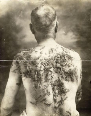 <strong> After German American farmer John Meints from Luverne, Minnesota, was beaten, tarred, and feathered by a group of his neighbors in 1918 for not buying war bonds, Meints used these photographs to .</strong> A) inform Germany of how German Americans were being treated in America B) complain to Congress and President Wilson about violence toward German Americans C) shock Americans about the mistreatment of innocent German Americans D) successfully sue the members of the mob who attacked him