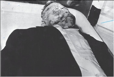 <strong> Why did the black Northern press choose to pair the image of Emmett Till's battered corpse with that of a smiling image of him with his mother Mamie Till-Bradley?</strong> A) They wanted to convince the Mississippi jury to convict Till's murderers. B) They wanted to outrage their audience by showing how an innocent young boy was savagely beaten to death by racists. C) They wanted to caution their audience of what could happen to African Americans in the South if they were too forward with white people. D) They wanted to warn their audience of what could happen to anyone who played an active role in the Civil Rights Movement in the South.