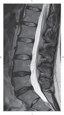 <strong>The figure below illustrates which of the following imaging planes?  </strong> A) Axial B) Coronal C) Sagittal D) Oblique <div style=padding-top: 35px> 