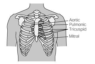 On the diagram below,place an X over the point of maximal impulse (PMI)where the stethoscope is placed to assess the apical pulse.  