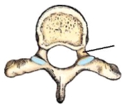 The part identified in this figure is the:   A)  body. B)  lamina. C)  pedicle. D)  transverse process.