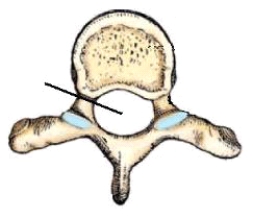 The part identified in this figure is the:   A)  vertebral arch. B)  vertebral foramen. C)  intervertebral foramina. D)  transverse foramen.