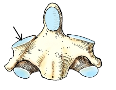 The part identified by the arrow on the vertebra in this figure is the:   A)  superior articular process. B)  inferior articular process. C)  transverse process. D)  lateral mass.