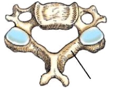The bony part identified in this figure is the:   A)  lamina. B)  pedicle. C)  superior articular process. D)  inferior articular process.