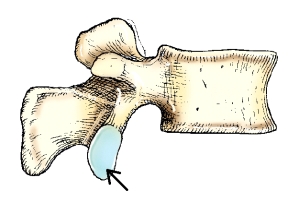 The part on the lumbar vertebra identified in this figure is the:   A)  superior vertebral notch. B)  inferior vertebral notch. C)  superior articular process. D)  inferior articular process.