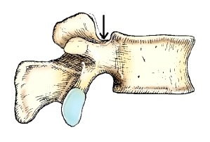 The part identified on the lumbar vertebra in this figure is the:   A)  superior vertebral notch. B)  inferior vertebral notch. C)  superior articular process. D)  inferior articular process.
