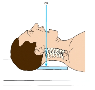 The x-ray projection demonstrated in this figure is the:   A)  AP cervical spine. B)  AP axial cervical spine. C)  AP,open mouth,atlas and axis. D)  AP,Fuchs method,atlas and axis.