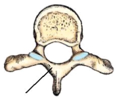 The part identified on the vertebra above is the:   A)  pedicle. B)  lamina. C)  transverse process. D)  superior articular process.