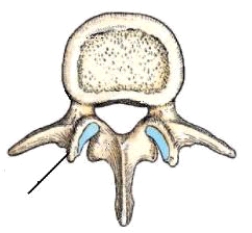 The part identified on the vertebrae above is the:   A)  pedicle. B)  lamina. C)  spinous process. D)  mammillary process.