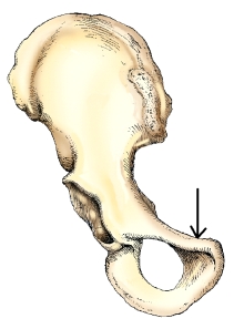 Which ramus is labeled with the arrow in this figure?   A)  Superior pubic B)  Inferior pubic C)  Superior ischial D)  Inferior ischial