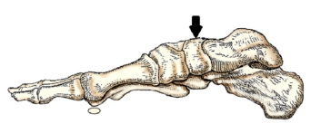 The bone of the foot indicated by the arrow in this figure is the:   A)  navicular. B)  talus. C)  calcaneus. D)  medial cuneiform.
