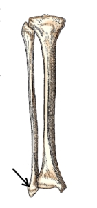 The bone part identified by the arrow in this figure is the:   A)  lateral condyle. B)  medial condyle. C)  lateral malleolus. D)  medial malleolus.