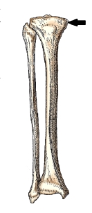 The bone part identified by the arrow in this figure is the:   A)  medial epicondyle. B)  tibial tuberosity. C)  medial malleolus. D)  medial condyle.