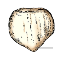 The area identified on the patella in this figure is the:   A)  apex. B)  base. C)  inferior articulating surface. D)  superior articulating surface.