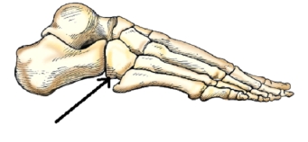The bone identified by the arrow in this figure is the:   A)  tibia. B)  cuboid. C)  talus. D)  navicular.